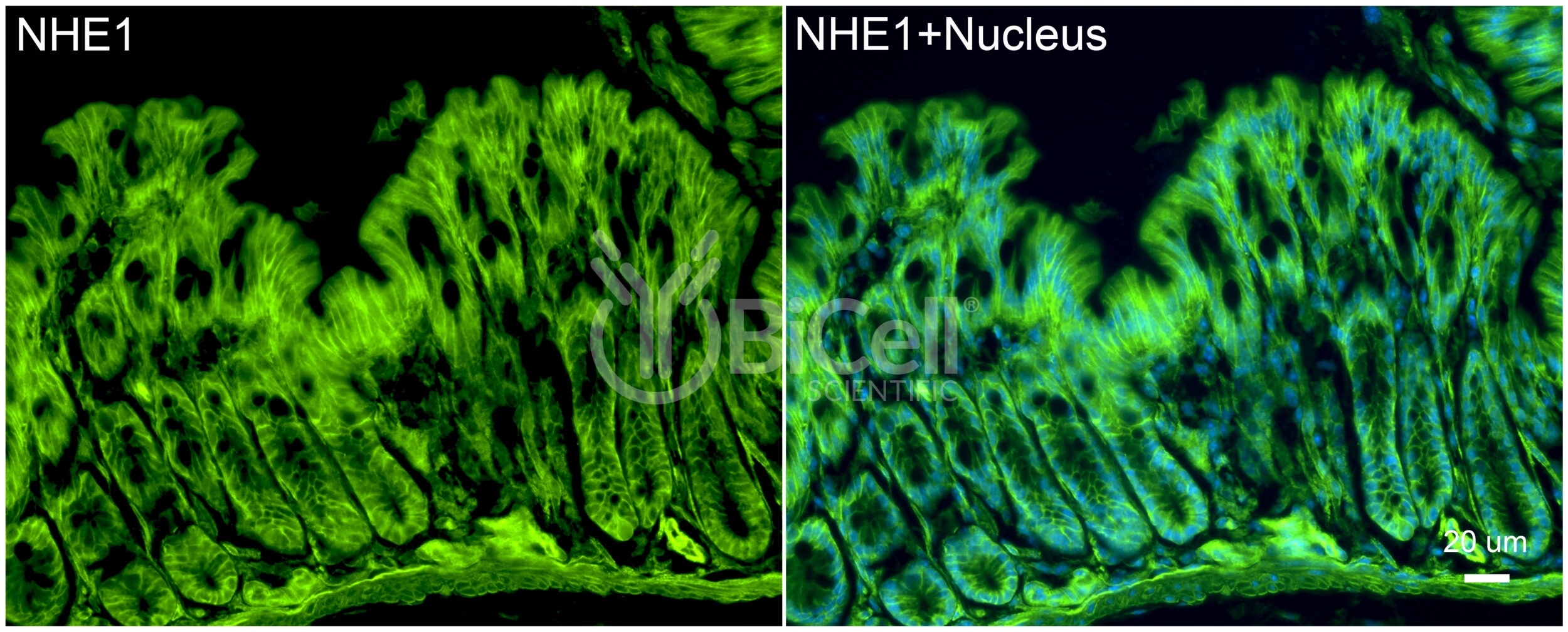 NHE1 (Slc9a1) Antibody