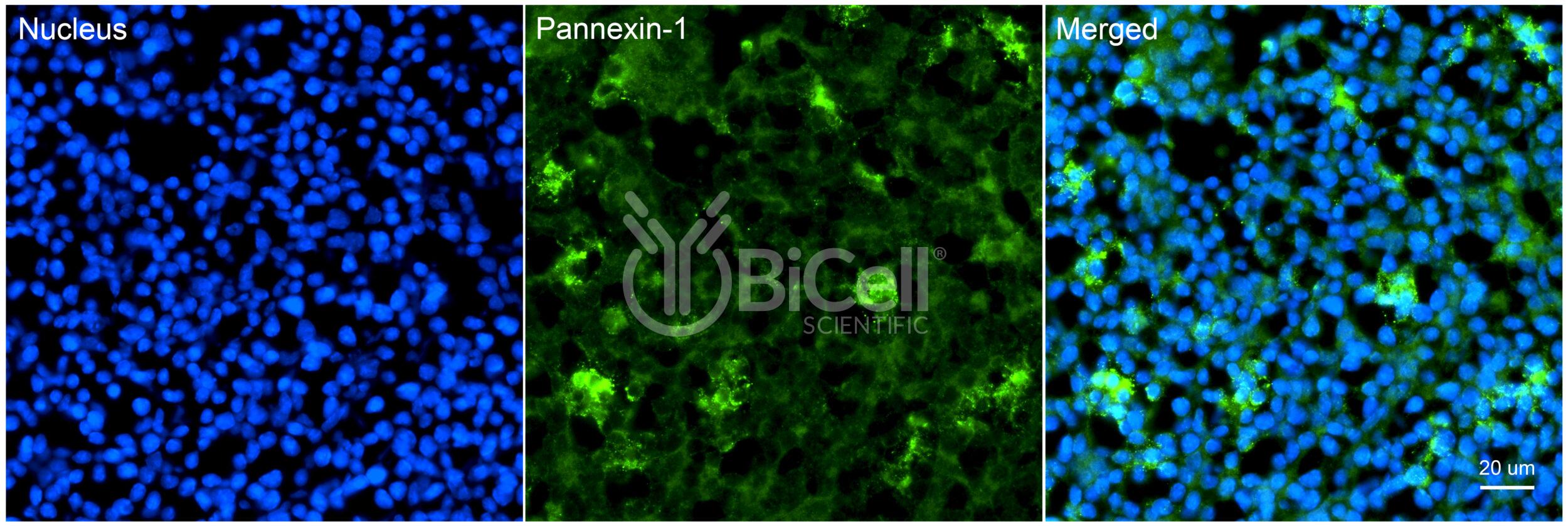 Pannexin-1 (PANX1) Antibody
