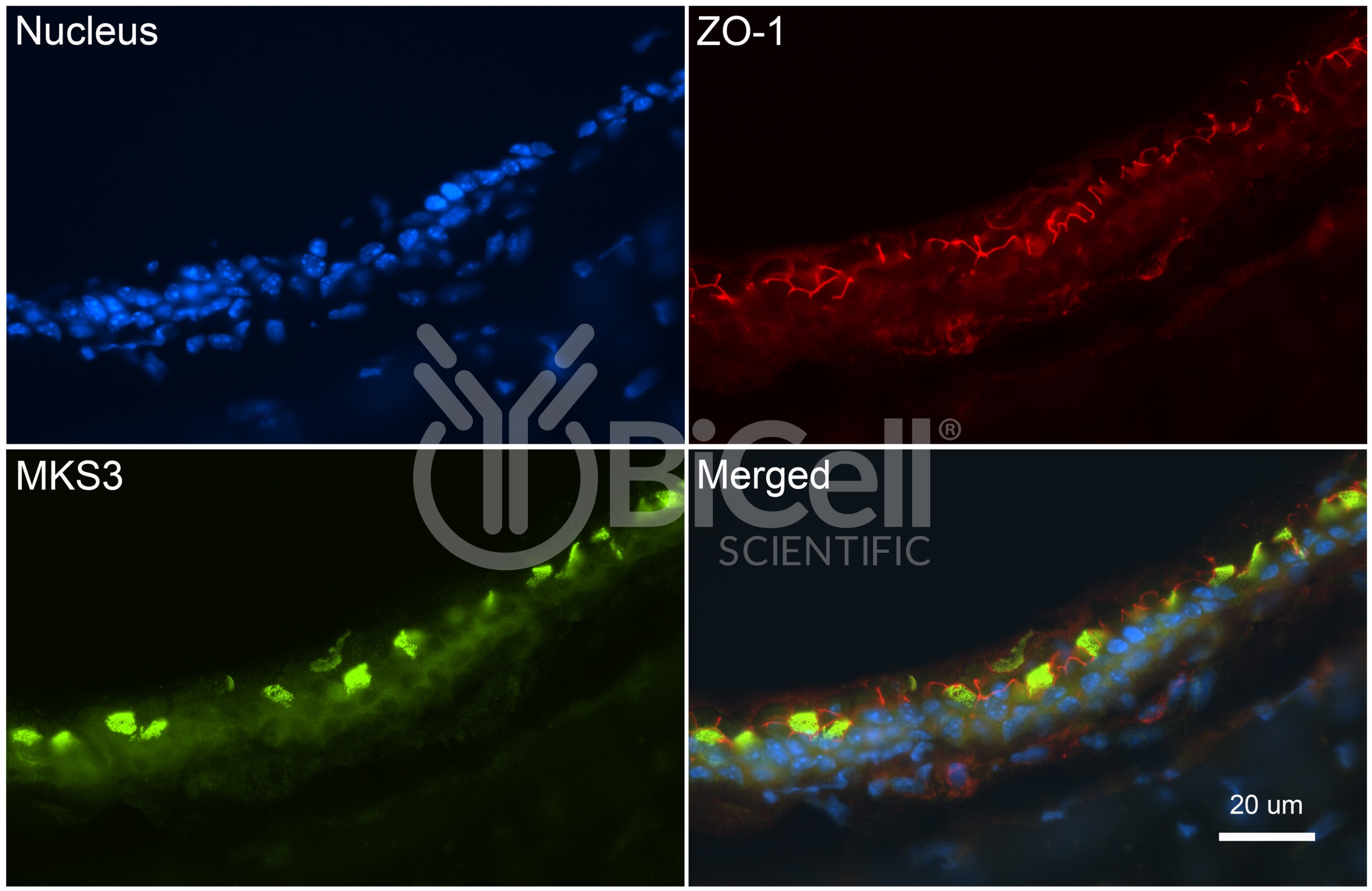 MKS3 (NPHP11 or Meckelin or TMEM67) Antibody