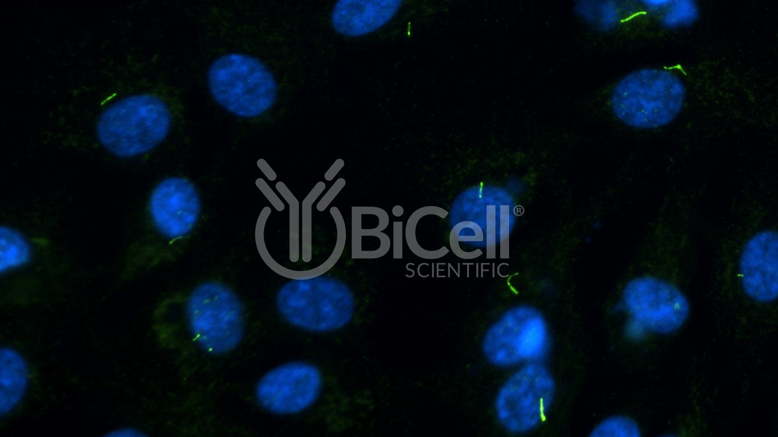 ARL13B (Human) (ARL2L1) HiRe Antibody
