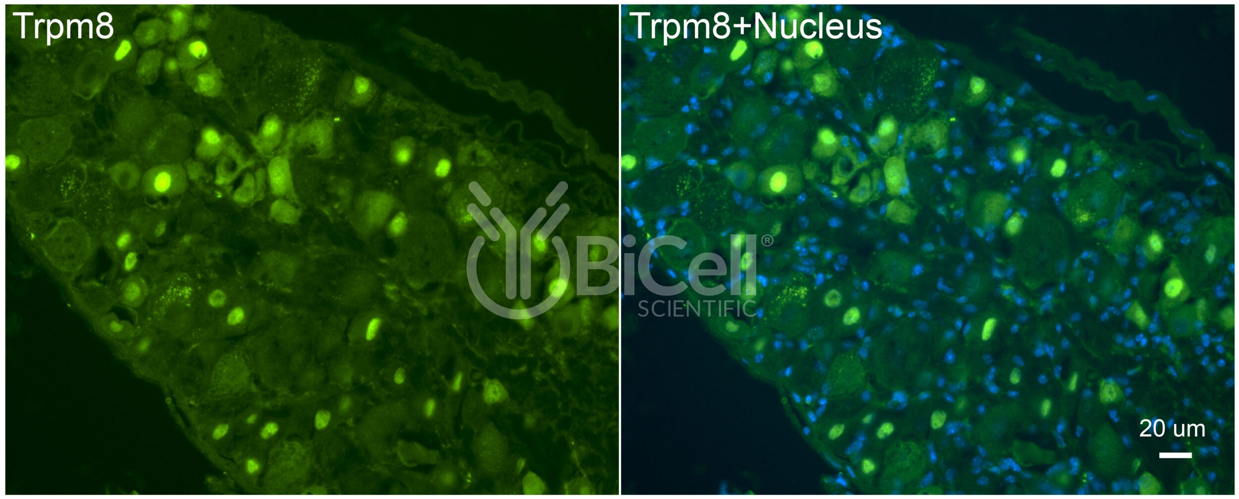 Trpm8 Antibody
