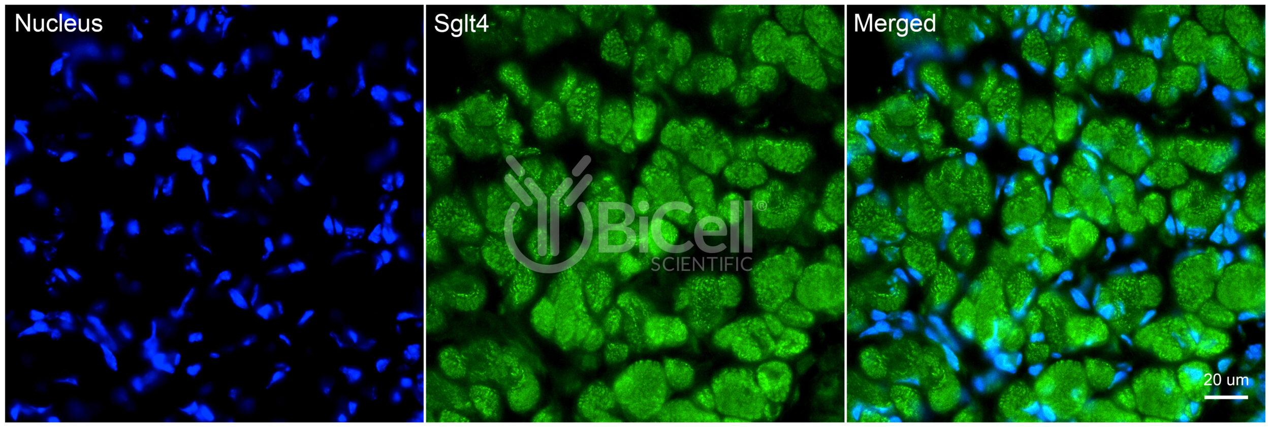 SGLT4 (Slc5a9) Antibody