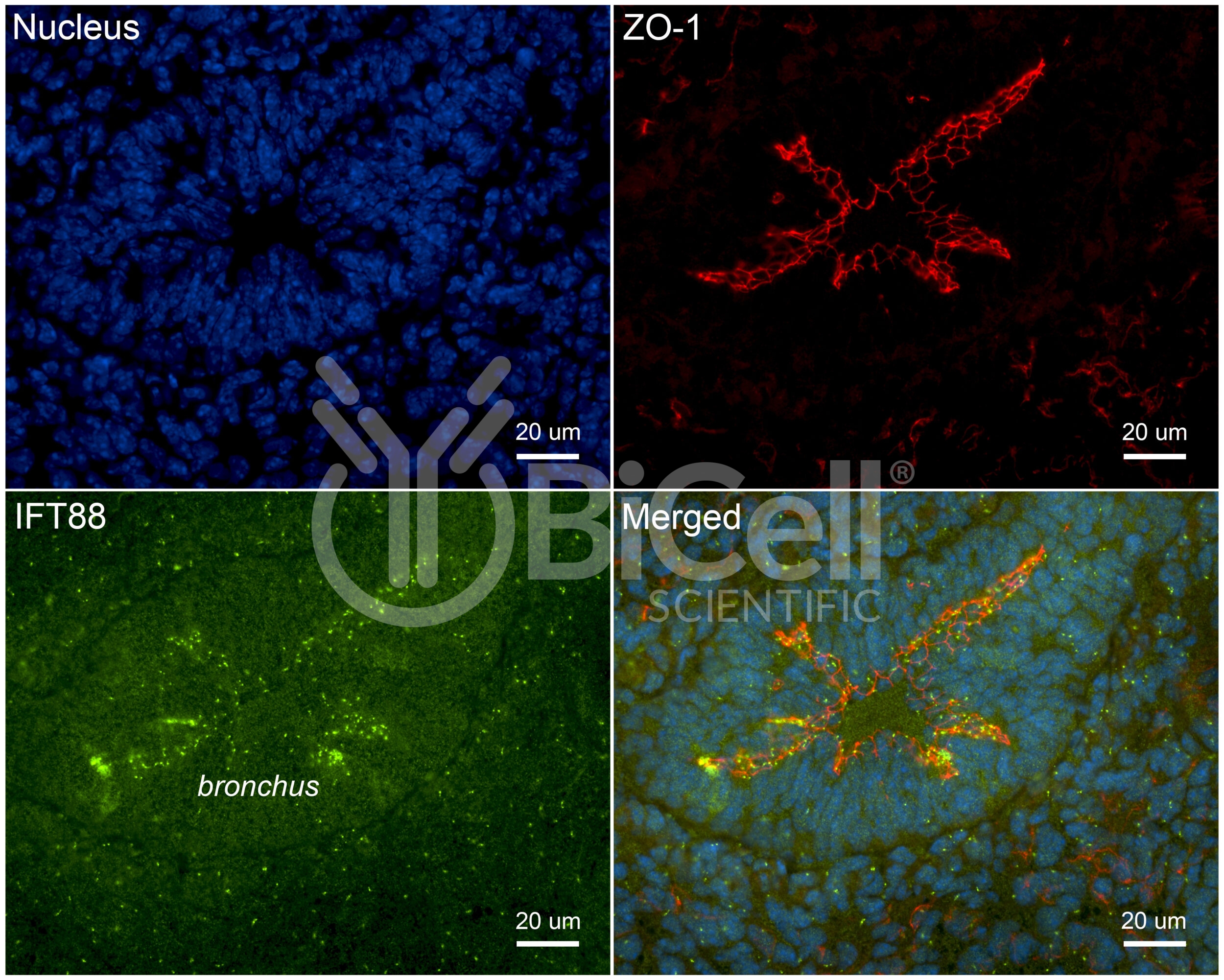 IFT88 Antibody