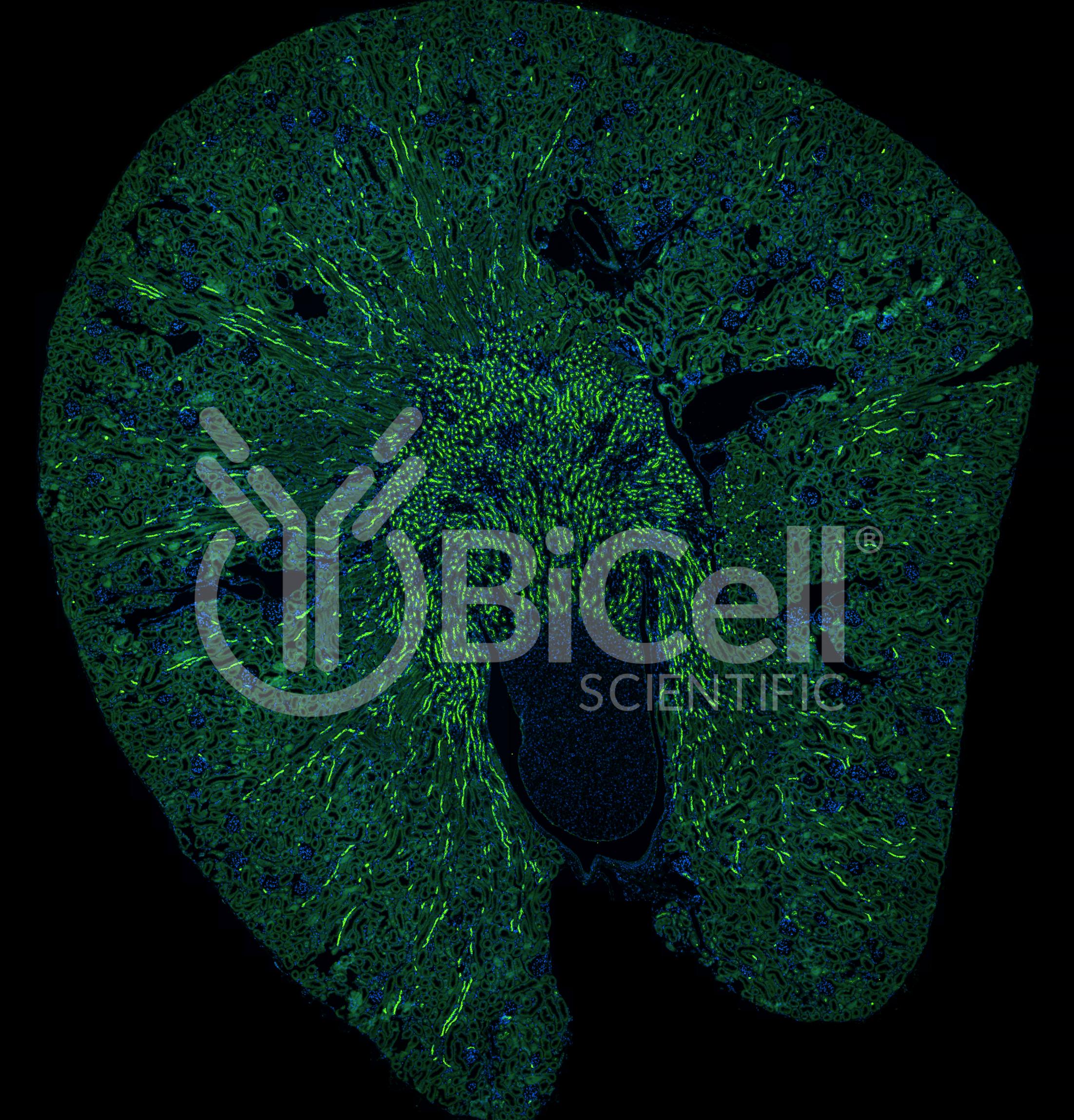 ROMK (Kir1.1 or KCNJ1) Antibody