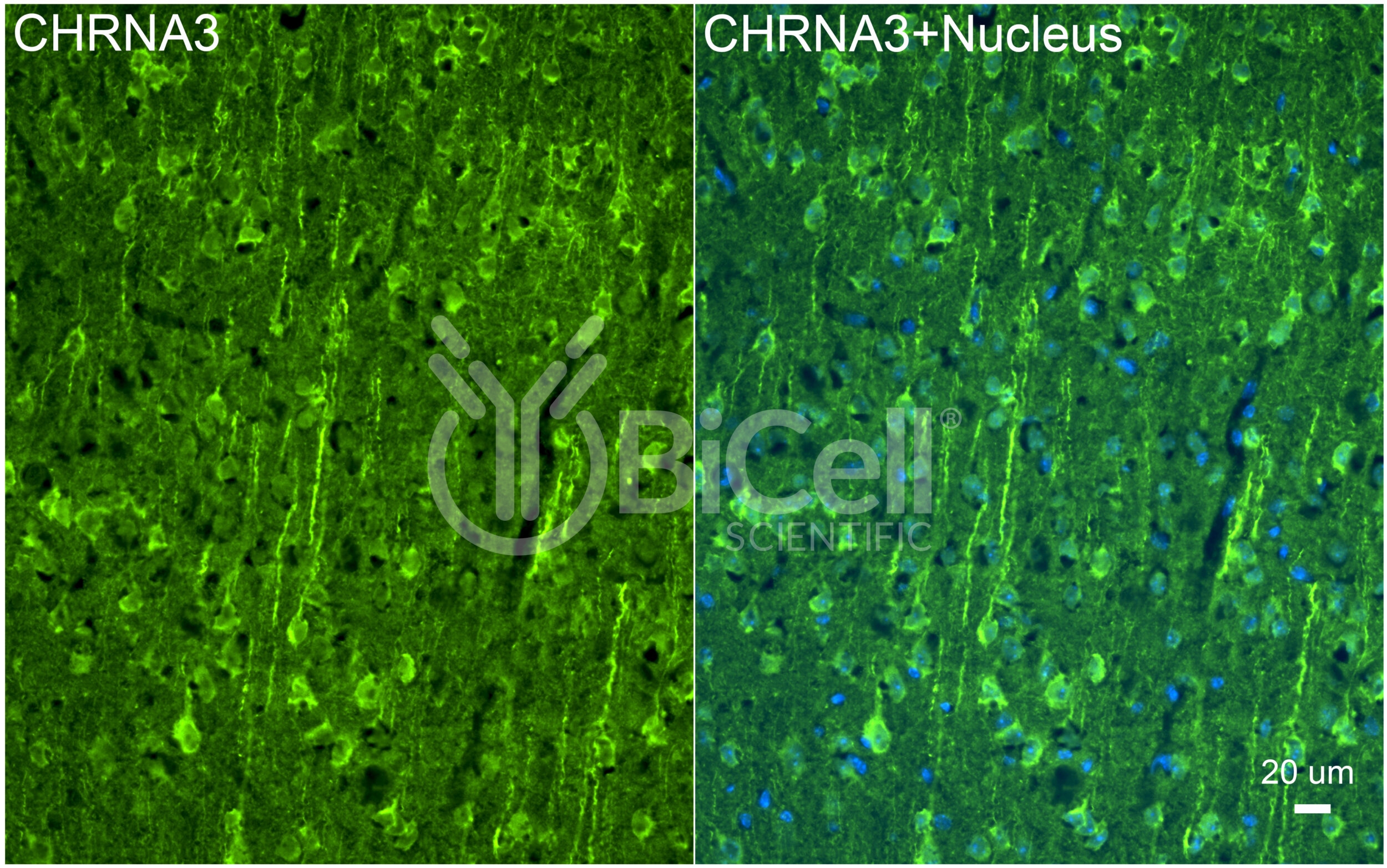 CHRNA3 (NACHRA3) Antibody