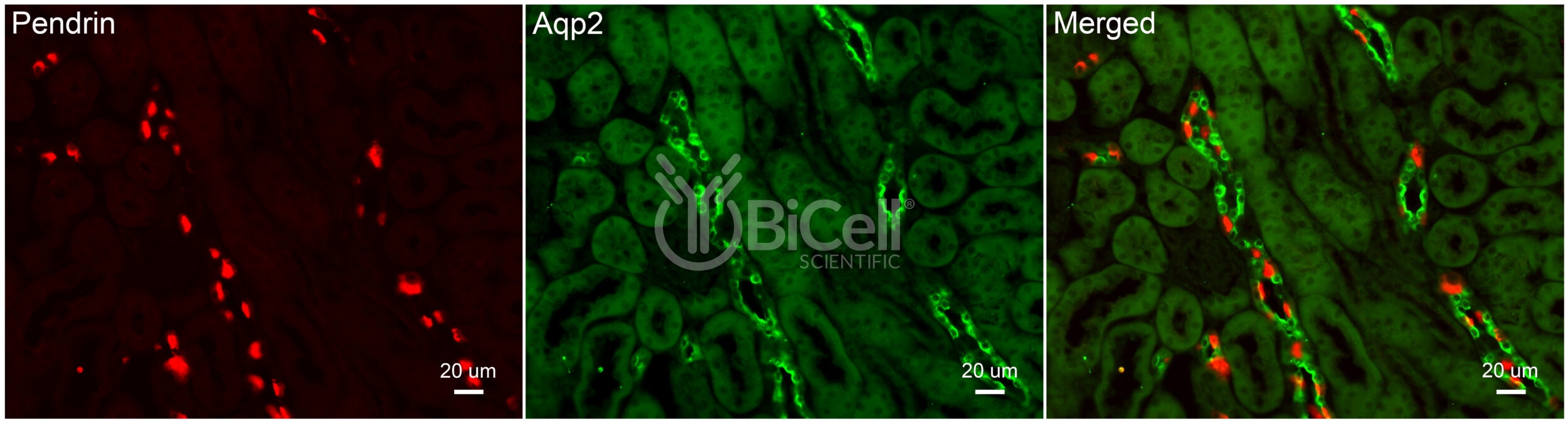 Aquaporin-2 (AQP2) (rat) Antibody