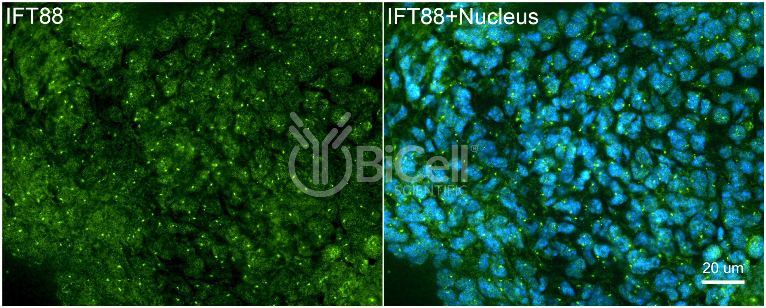 IFT88 Antibody