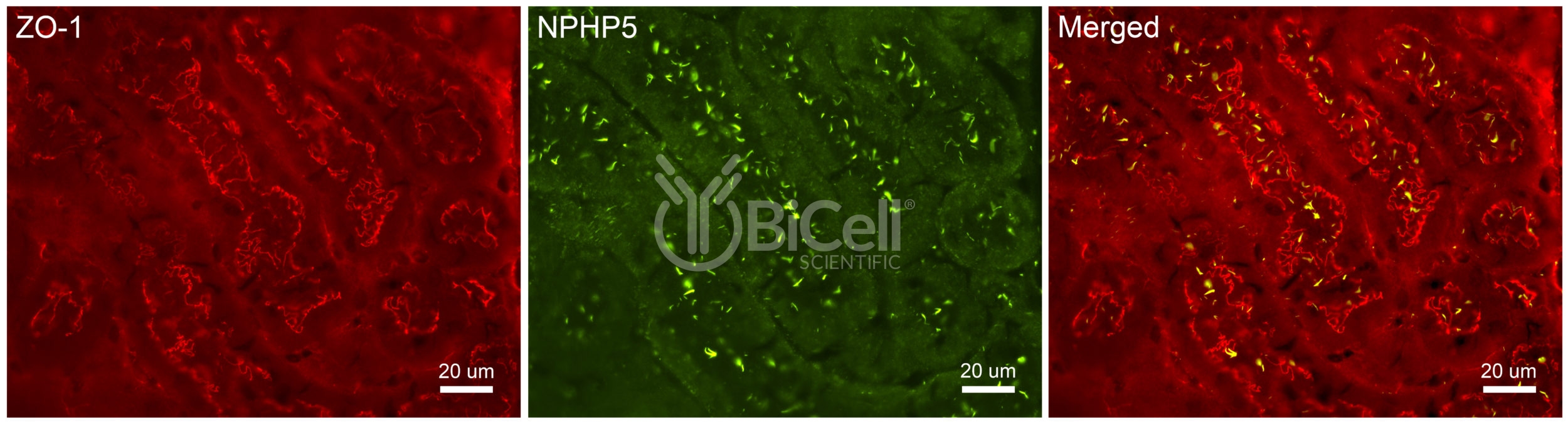 Nephrocystin-5 (NPHP5 or IQCB1) Antibody