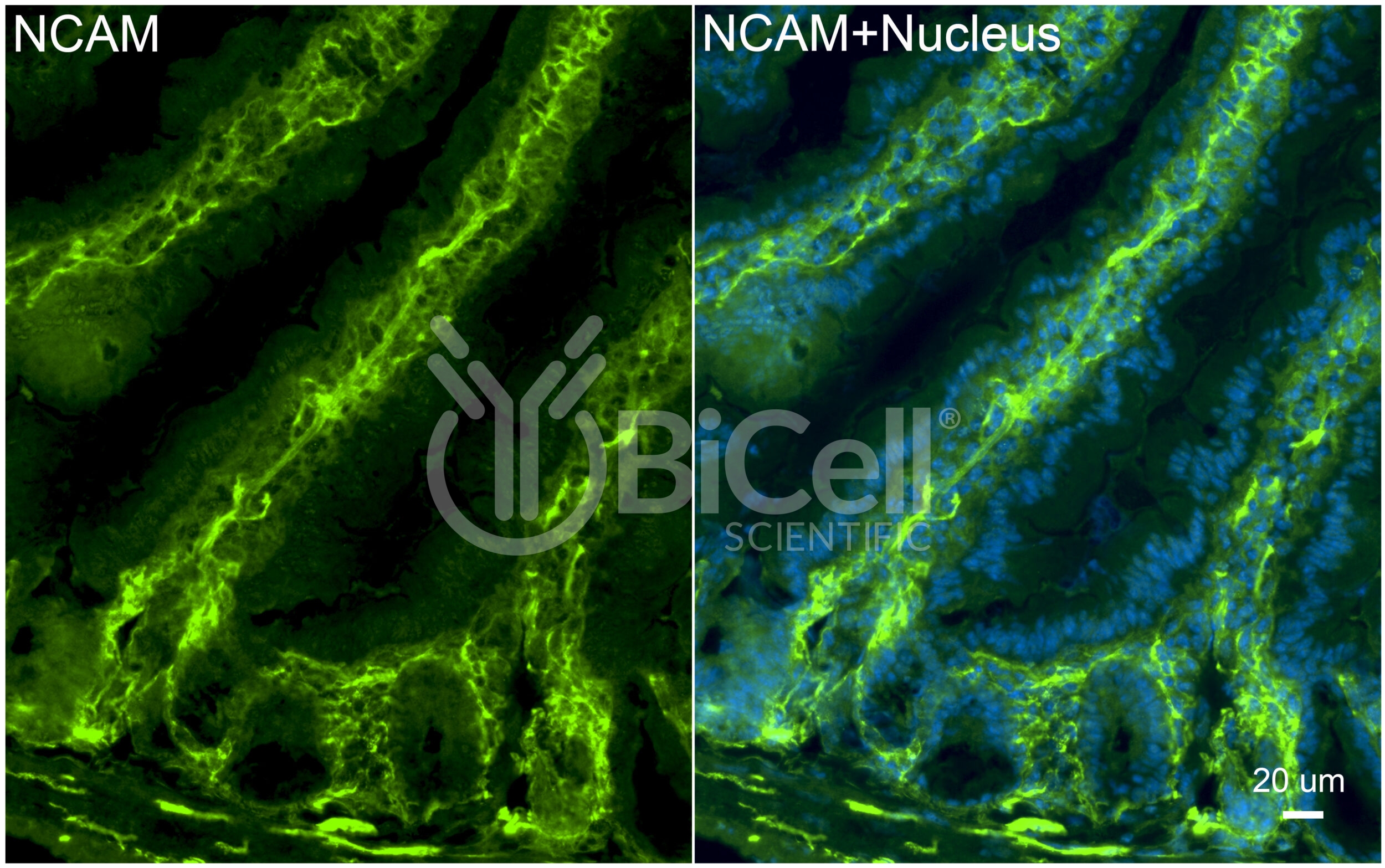 NCAM (CD56) Antibody