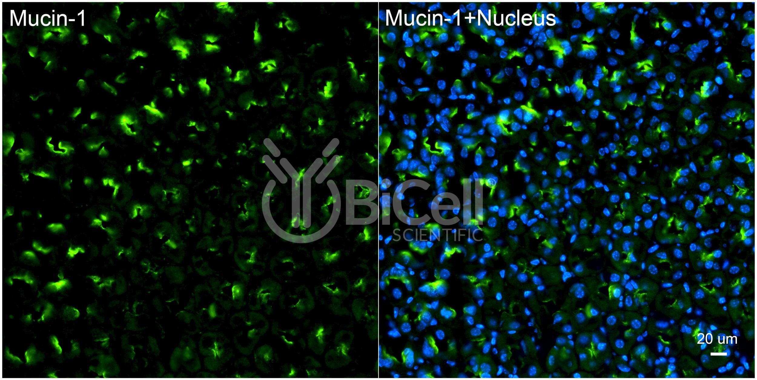 Mucin-1 (MUC1 or CD227) Antibody