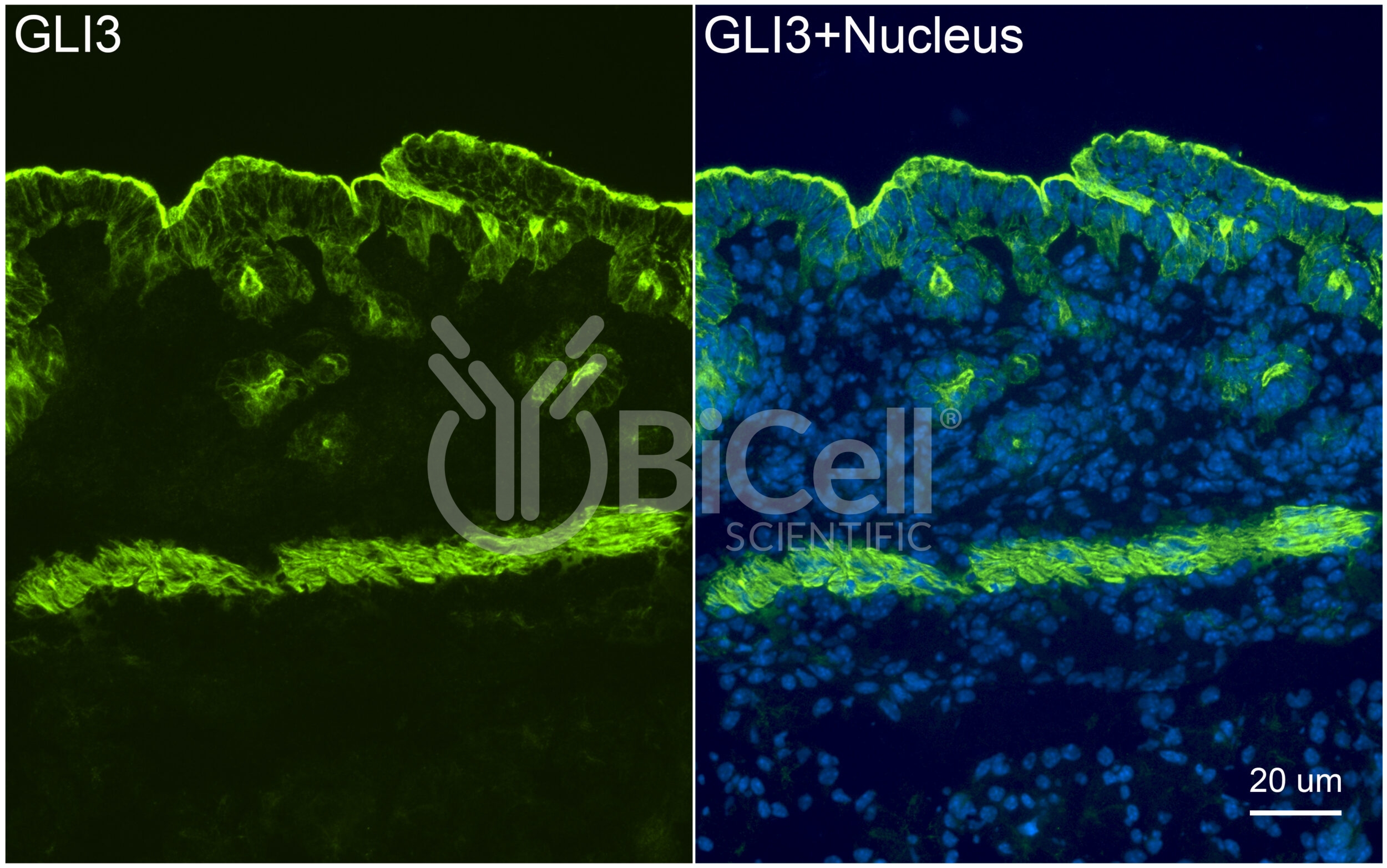 GLI3 Antibody