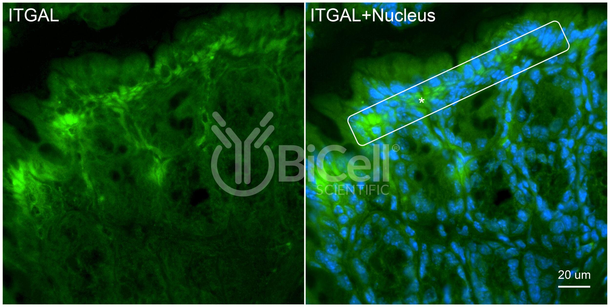 Integrin alpha-L (ITGAL or CD11a) Antibody