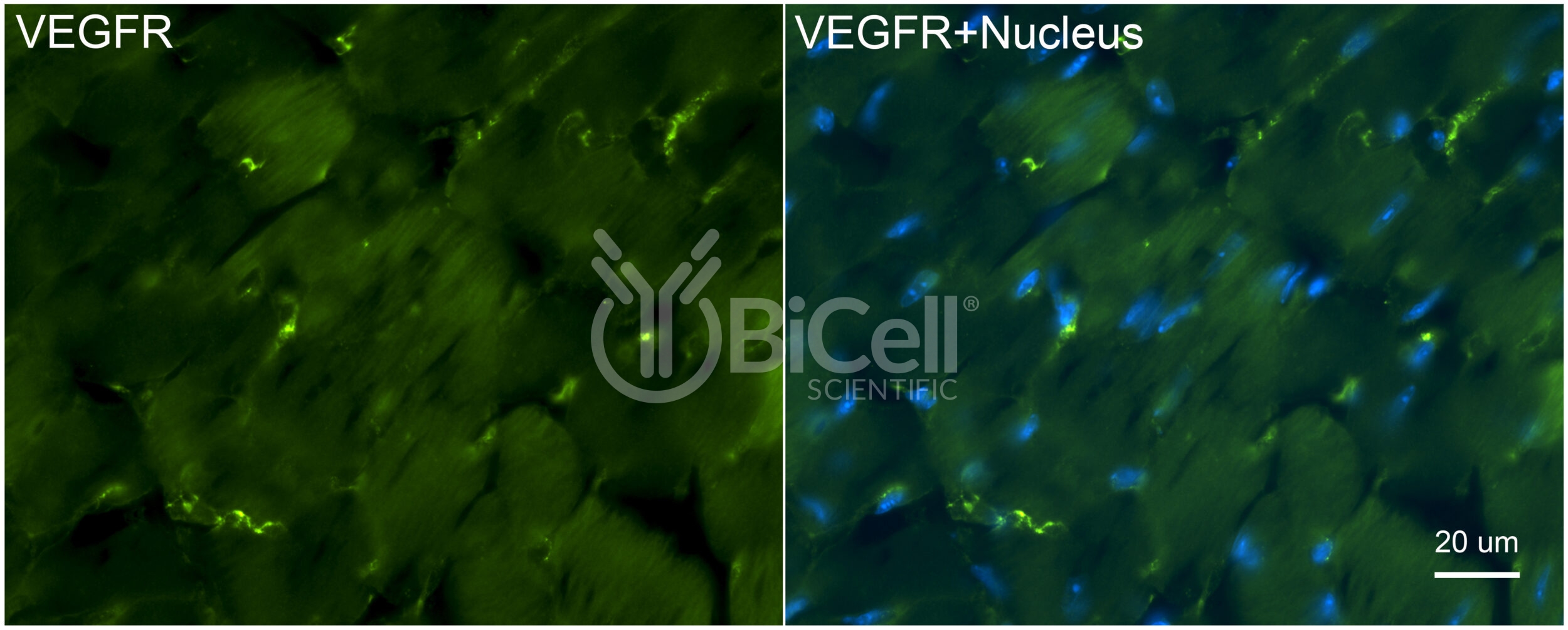 VEGFR1 (FLT1) Antibody