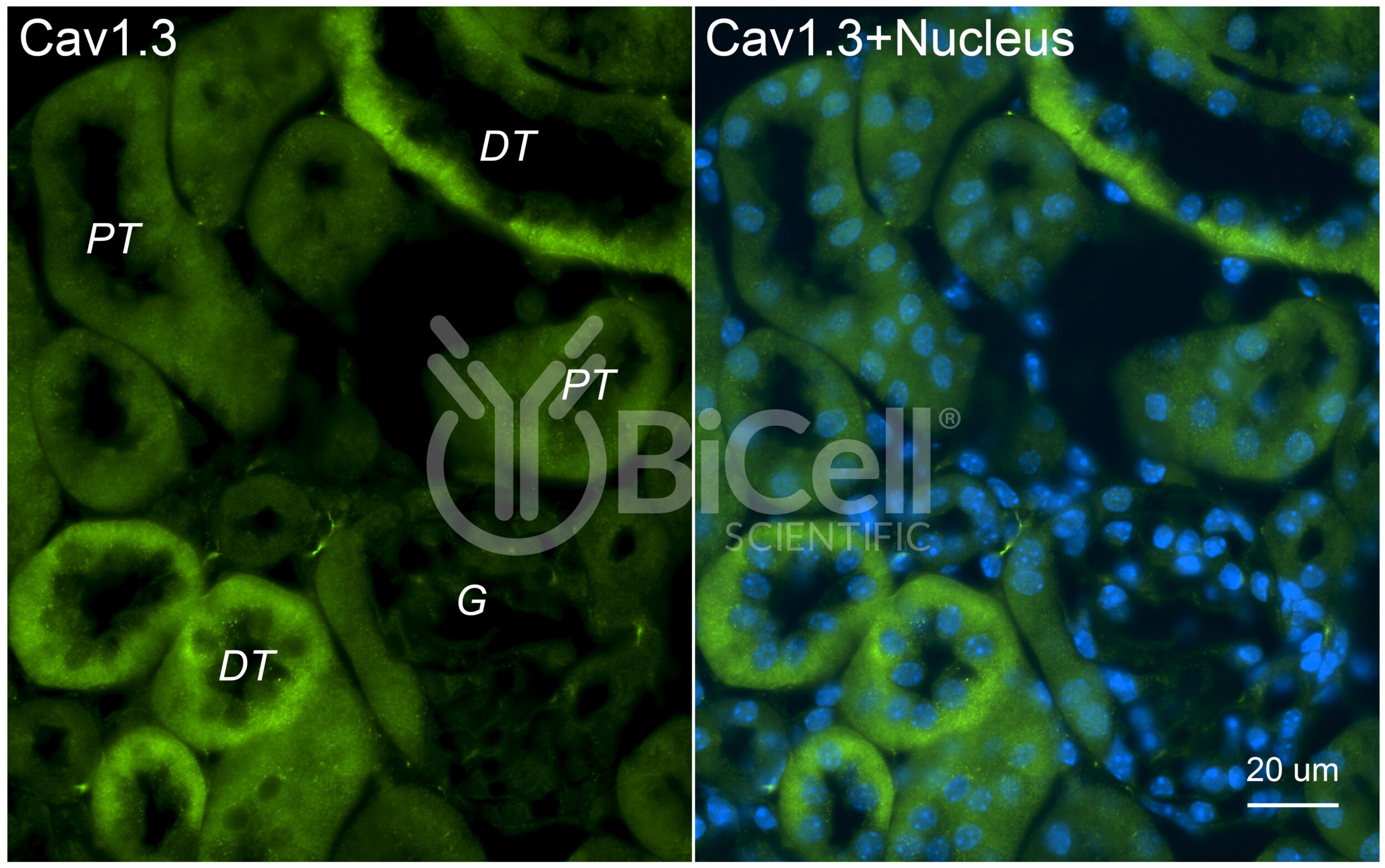 CACNA1D (Cav1.3) Antibody