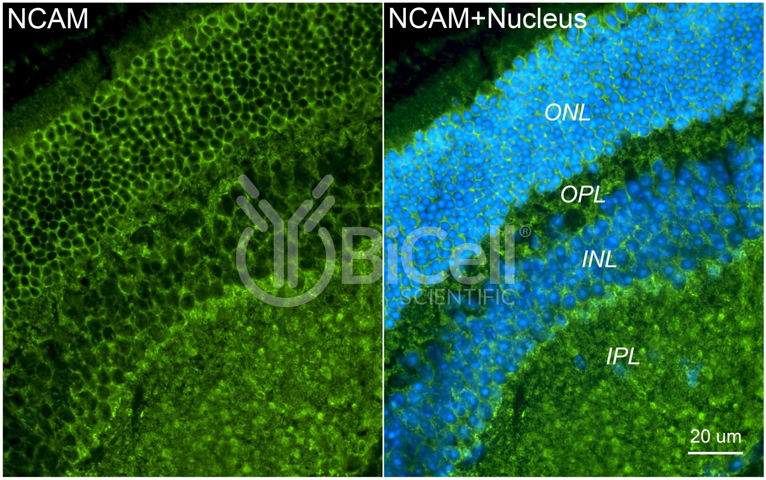 NCAM (CD56) Antibody