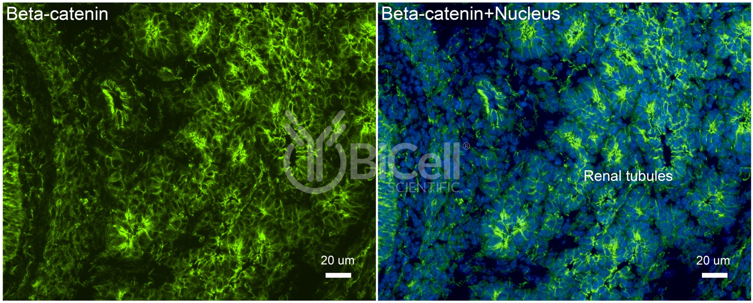 Beta-Catenin (Ctnnb1) Antibody