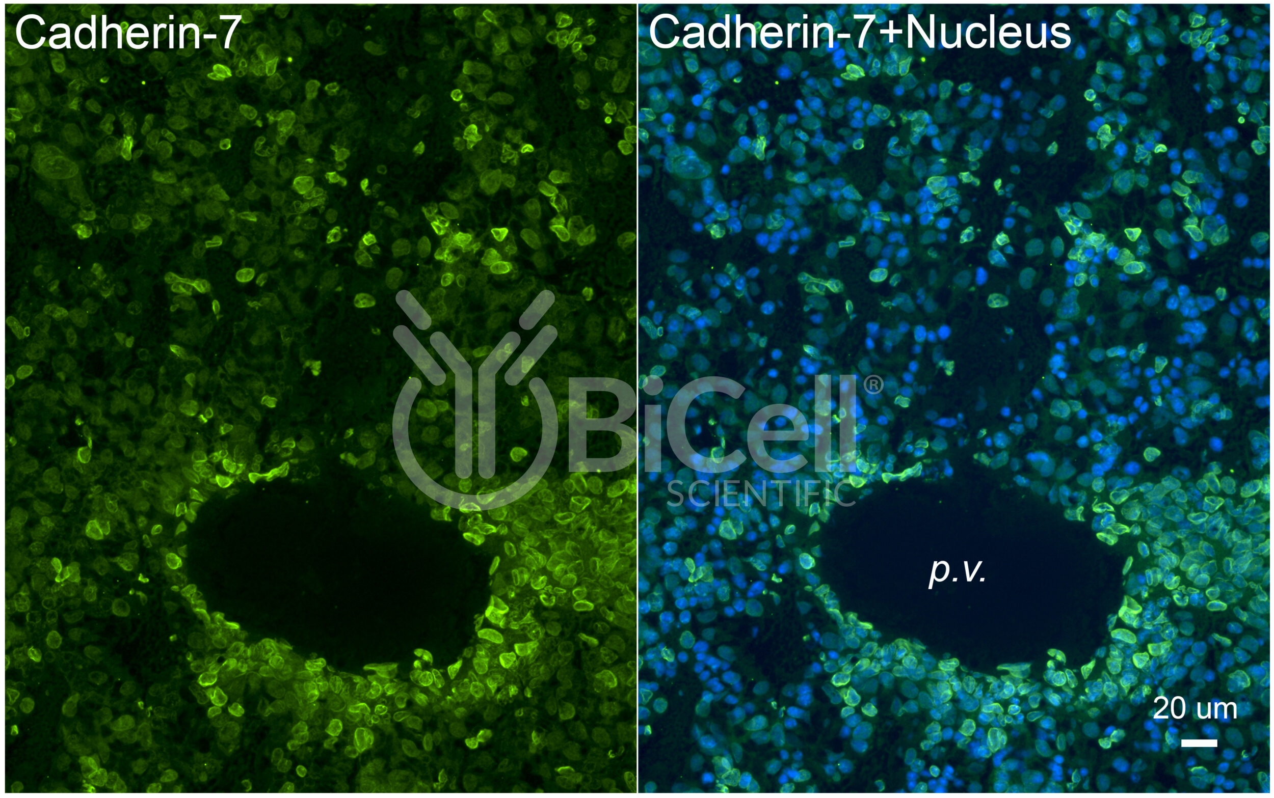 Cadherin-7 (CDH7) Antibody