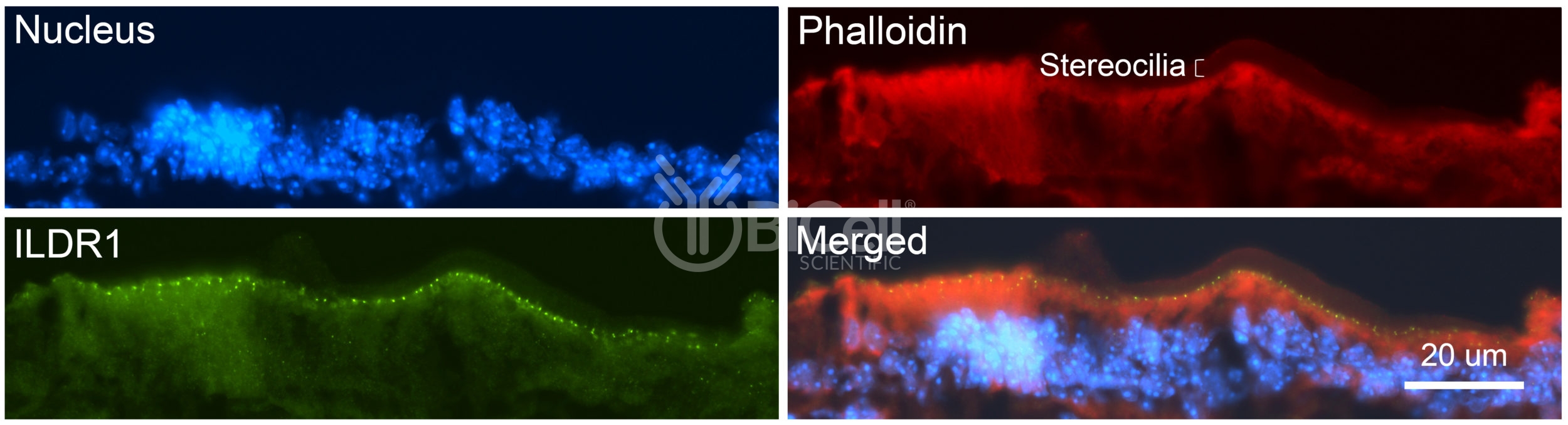 ILDR1 (Angulin-2) Antibody