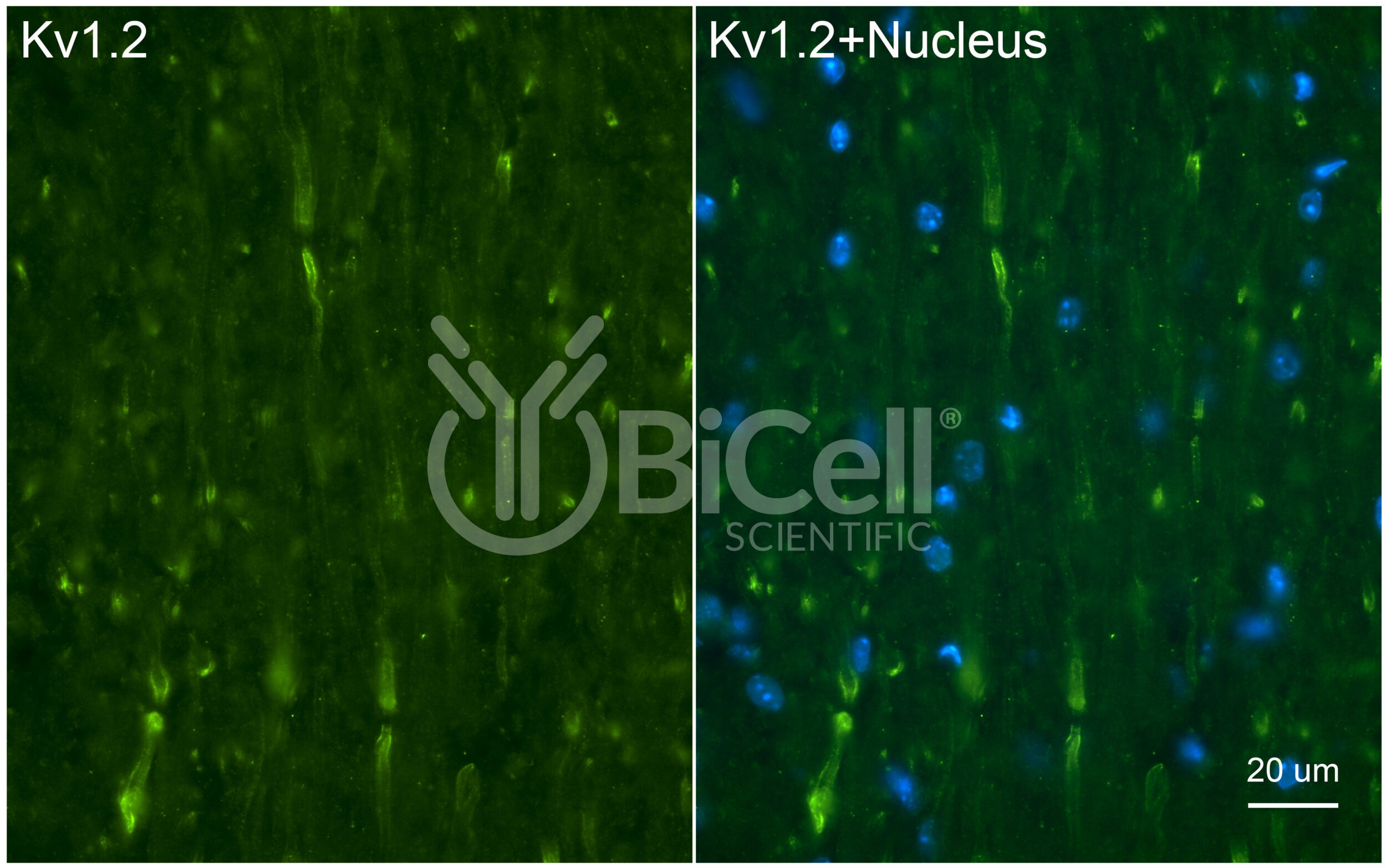 KCNA2 (Kv1.2) Antibody