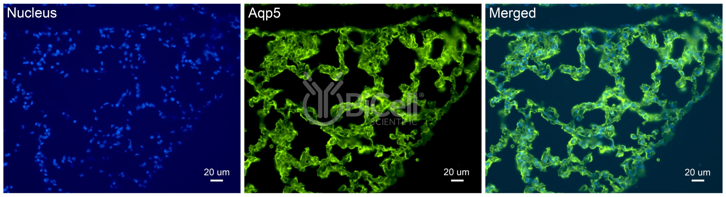 Aquaporin-5 (AQP5) Antibody