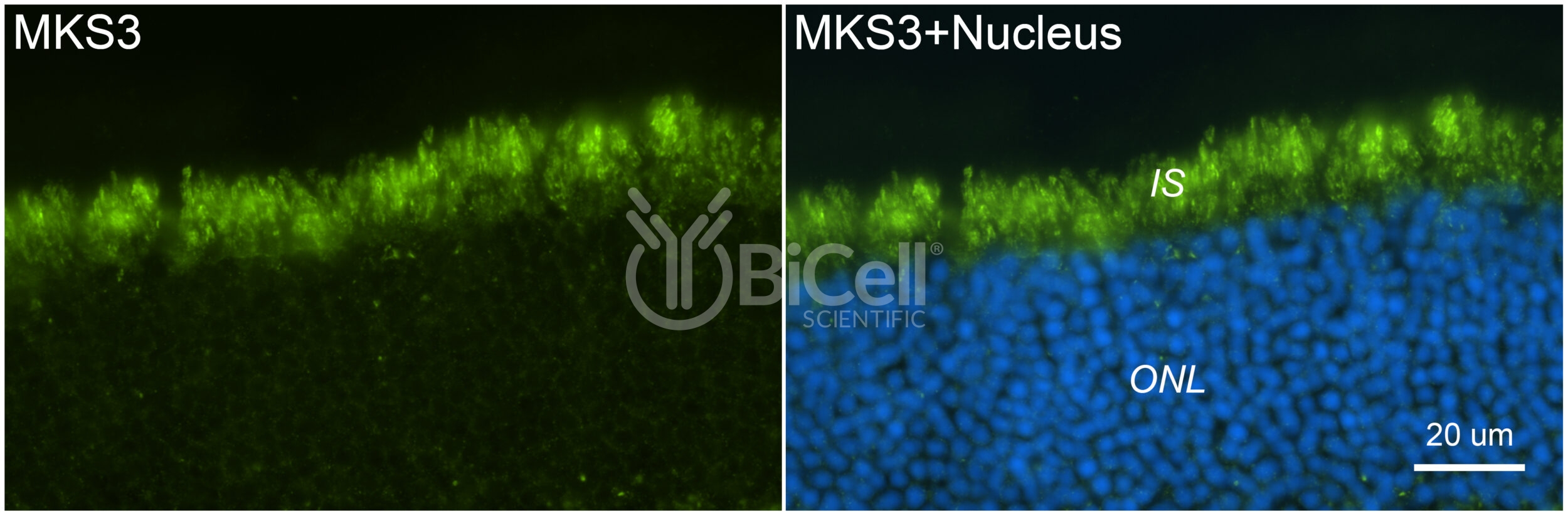 MKS3 (NPHP11 or Meckelin or TMEM67) Antibody