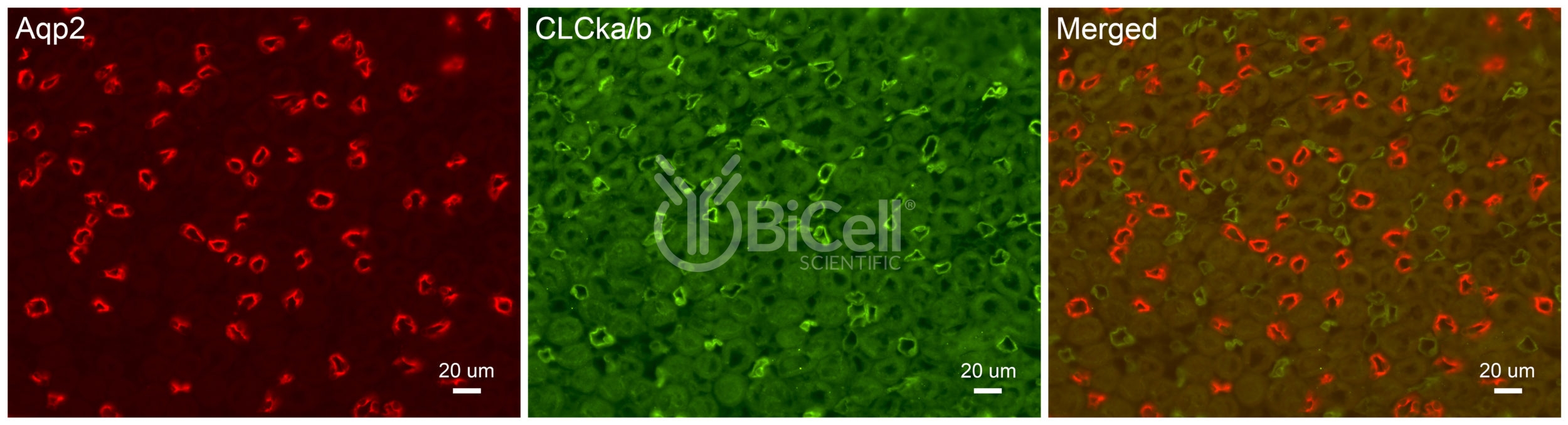 CLC-Ka/b Antibody