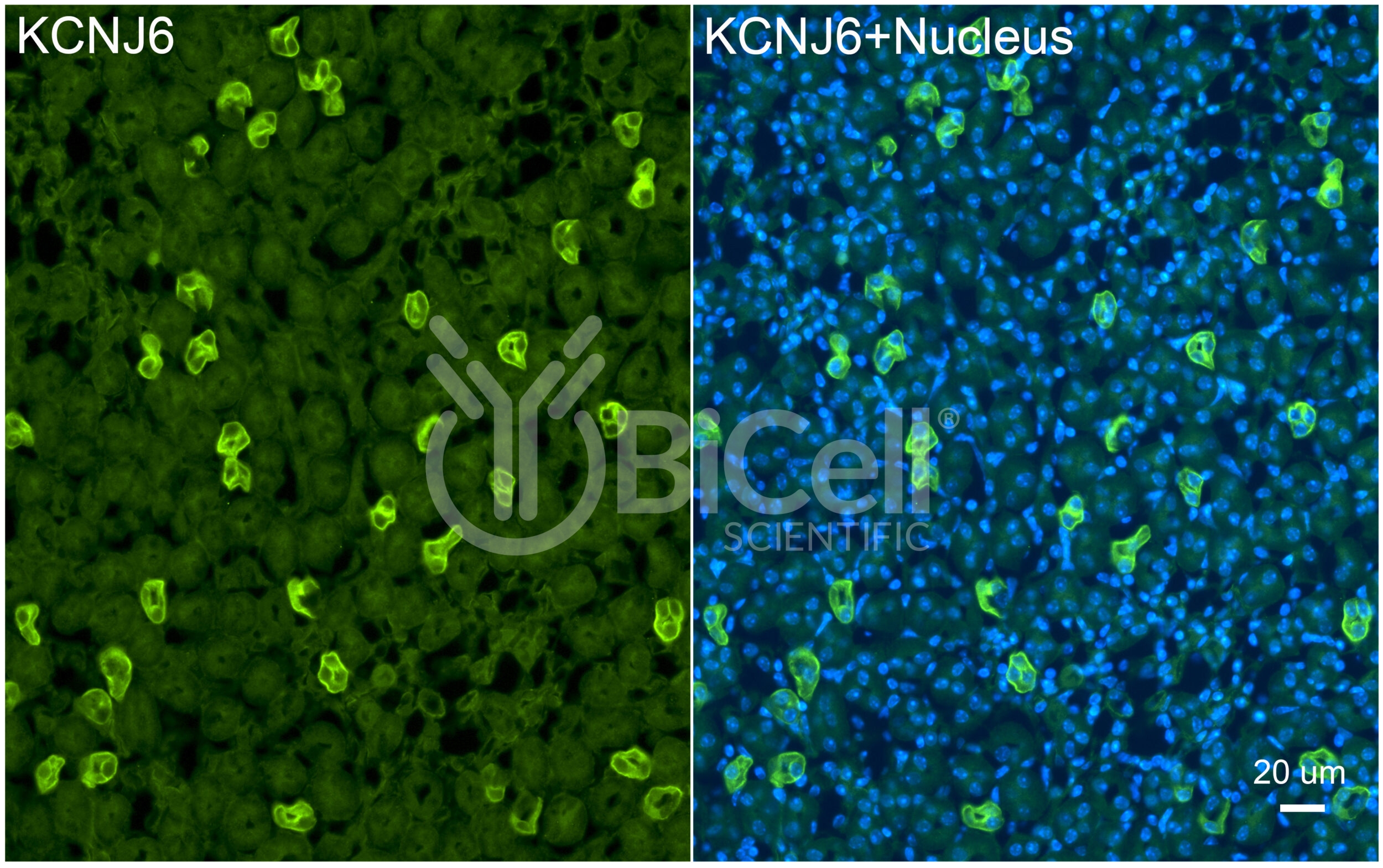 KCNJ6 (Kir3.2 or GIRK2) Antibody