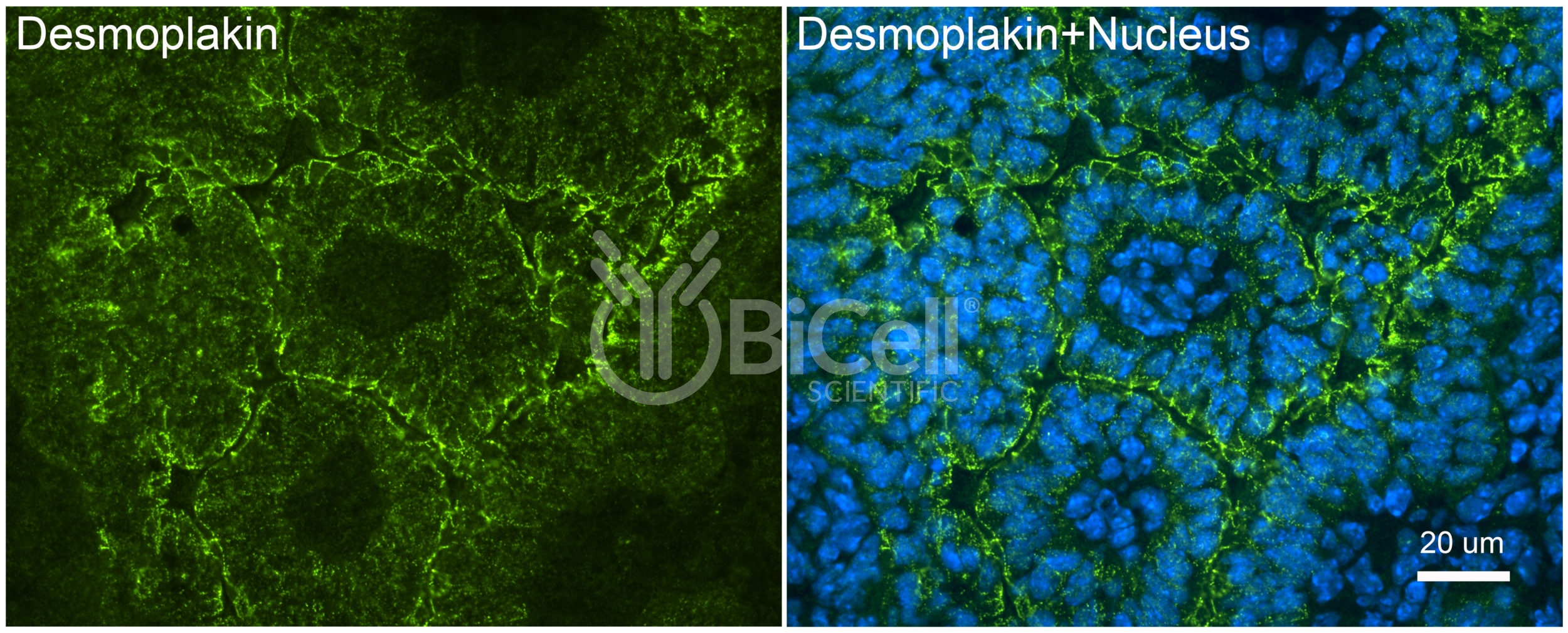 Desmoplakin (DSP) Antibody